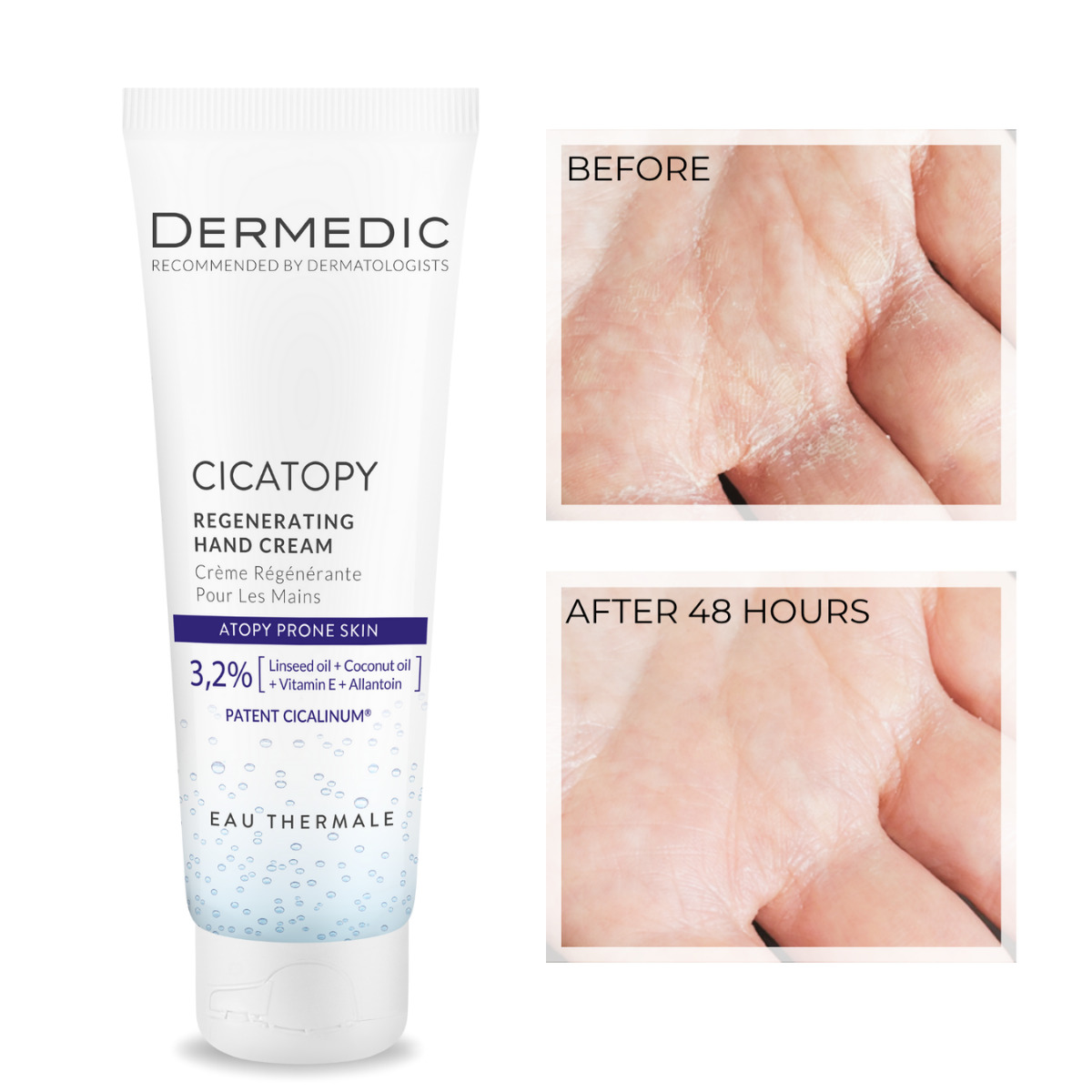 Cicatopy Regenerating Hand Cream 3
